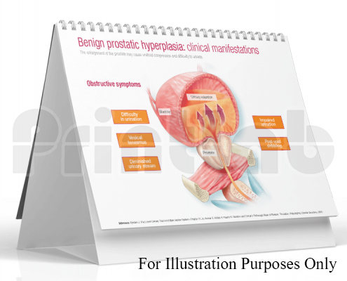 a3 flip chart printing